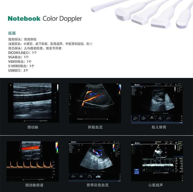 Kaier Medical Portable Color Ultrasound Machine Manufacturer provides portable color ultrasound handheld bedside color ultrasound equipment