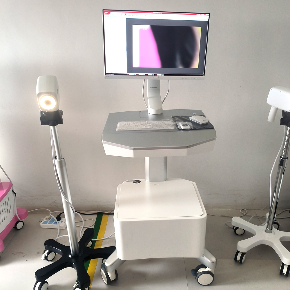 Digital electronic Colposcopy standard gynecological medical high-definition endoscope 2023 product trends