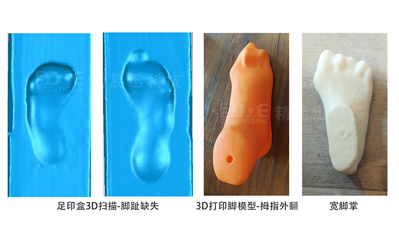 Foot measuring instrument used for 3D printing of foot models Customization of shoe precision and quick foot shape scanner Deposit