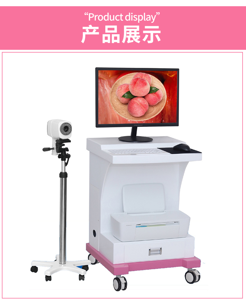 Digital electronic Colposcopy cart type gynecological vaginoscope vaginal digital imaging system