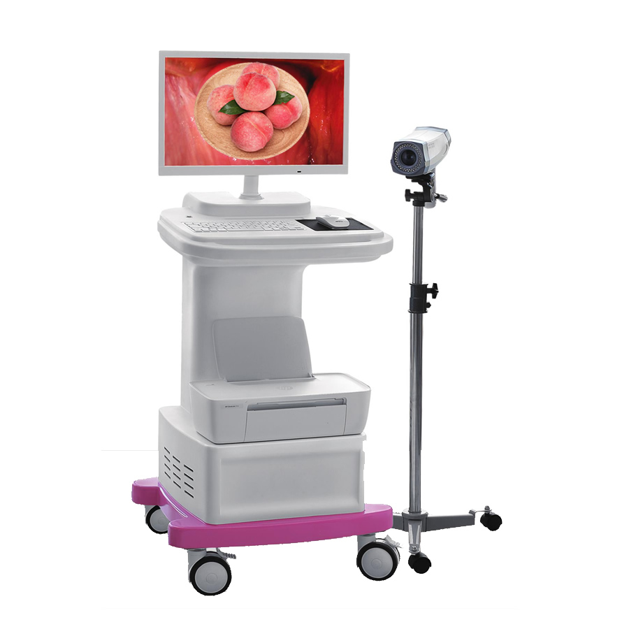 Digital electronic Colposcopy cart type gynecological vaginoscope vaginal digital imaging system