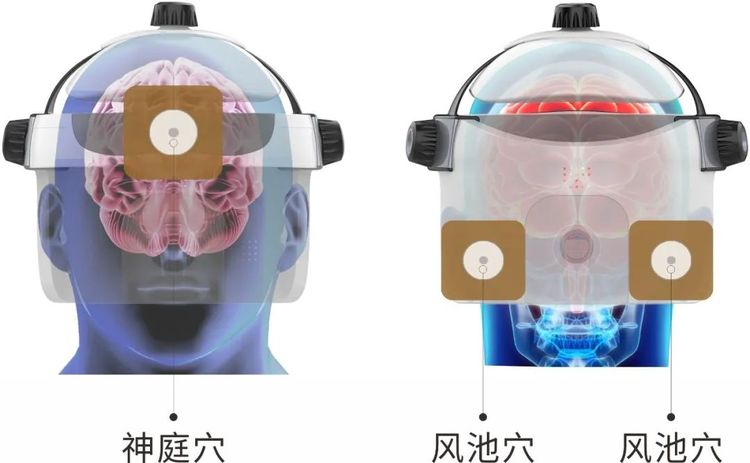 Baicaoling Transcranial Magnetic Stimulator ZL-N-800 Brain Circulation Dysfunction Treatment Instrument